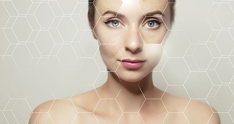 collagen protection